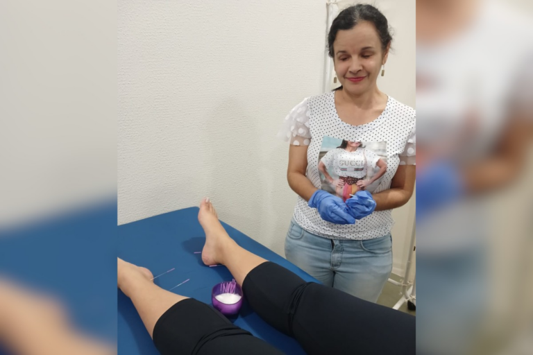 Superação e inclusão: mulher cega se destaca na massoterapia e aplica acupuntura