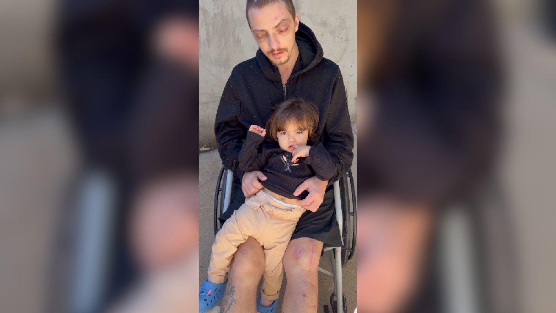 Marcão Raiz: a recuperação do influenciador corintiano após grave acidente