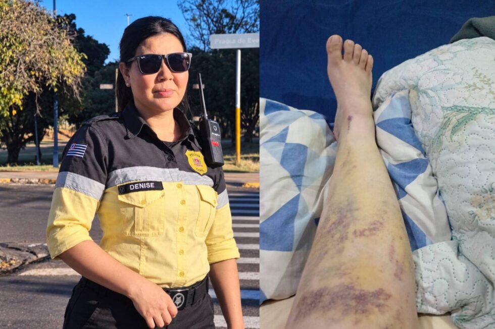 Agente de trânsito busca apoio para complexo tratamento após acidente